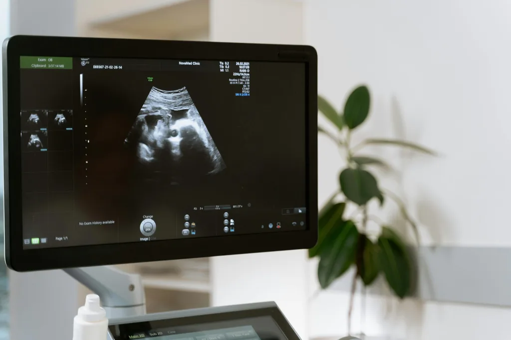 point of care ultrasound for midwives