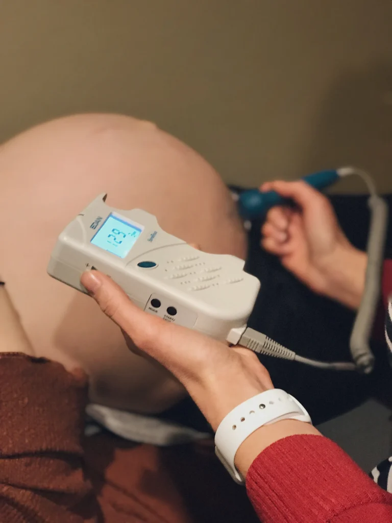 midwife ultrasound